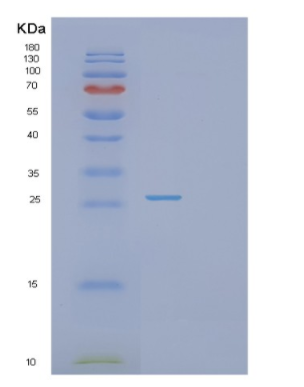 Recombinant Human PSMA2 Protein