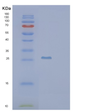 Recombinant Human PSMB10 Protein