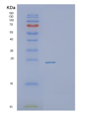 Recombinant Human PSMB2 Protein