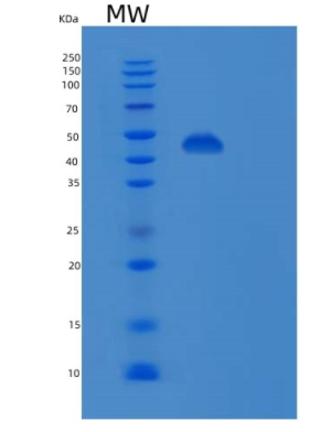 Recombinant Human PSMD13 Protein