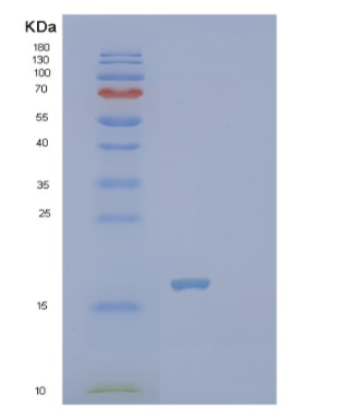 Recombinant Human PTRHD1 Protein