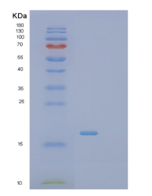 Recombinant Human PTS Protein
