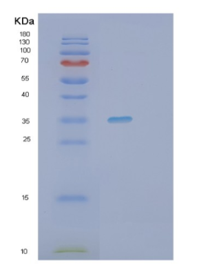 Recombinant Human PURB Protein