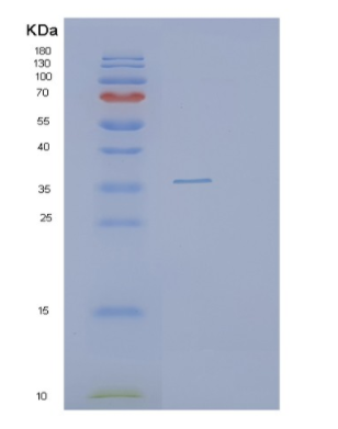 Recombinant Human PYCR2 Protein