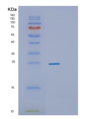 Recombinant Human RAB1A Protein