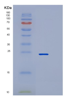Recombinant Human RAB22A Protein