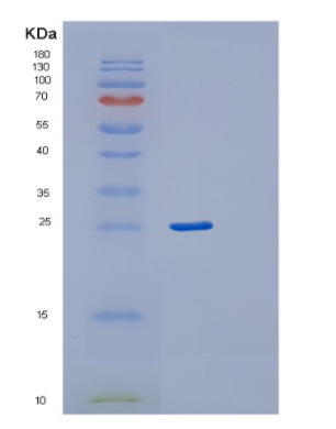 Recombinant Human RAB24 Protein