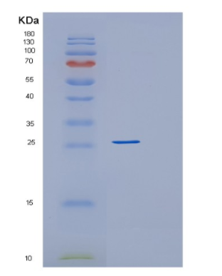 Recombinant Human RAB27A Protein