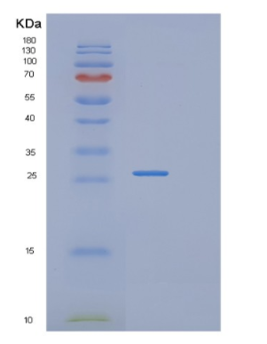 Recombinant Human RAB2B Protein