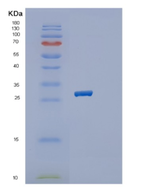 Recombinant Human RAB32 Protein