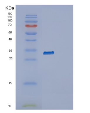 Recombinant Human RAB34 Protein