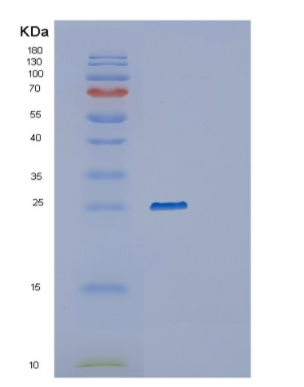 Recombinant Human RAB35 Protein