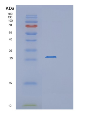 Recombinant Human RAB3B Protein