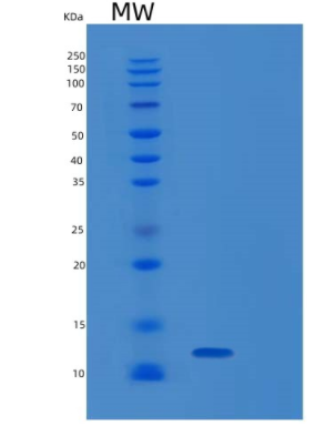 Recombinant Human RAMP3 Protein