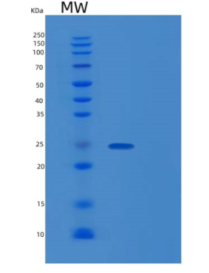 Recombinant Human RANBP1 Protein