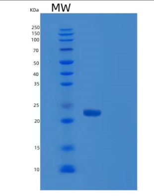 Recombinant Human RAP1B Protein