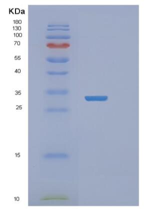Recombinant Human RASD2 Protein
