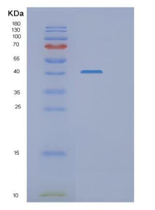 Recombinant Human RASSF1A Protein