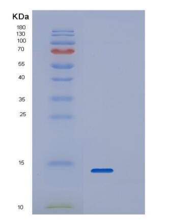 Recombinant Human RPAIN Protein