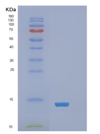 Recombinant Human RARα Protein