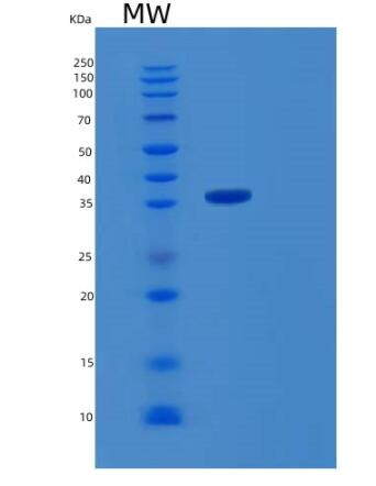Recombinant Human RBKS Protein
