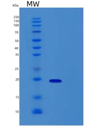 Recombinant Human RBM3 Protein
