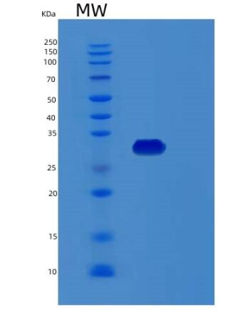Recombinant Human RCHY1 Protein