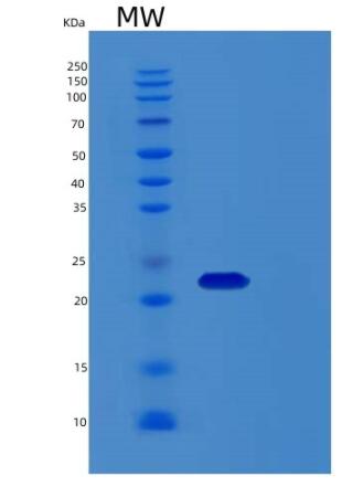 Recombinant Human Recoverin Protein