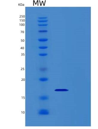 Recombinant Human REG4 Protein