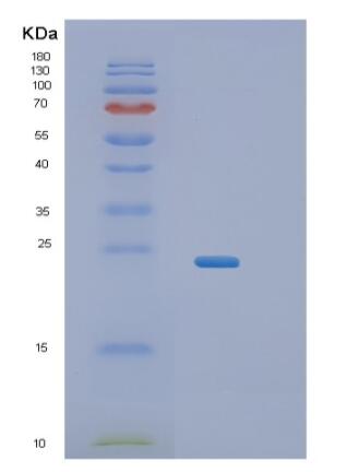 Recombinant Human RERG Protein