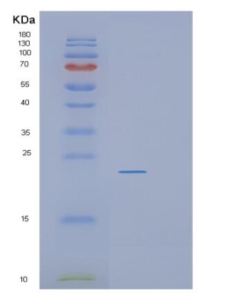 Recombinant Human RGS10 Protein