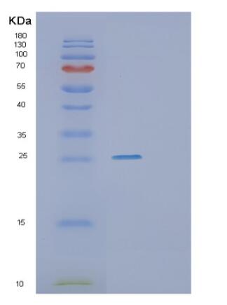 Recombinant Human RHOA Protein