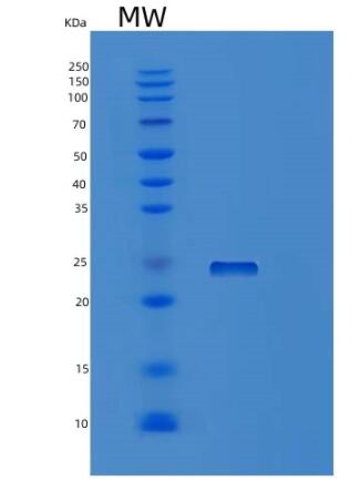 Recombinant Human RHOQ Protein