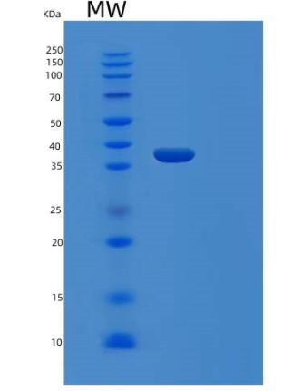 Recombinant Human RLBP1 Protein