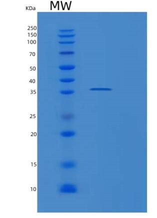 Recombinant Human RNASEH2A Protein