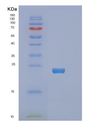 Recombinant Human RNF4 Protein