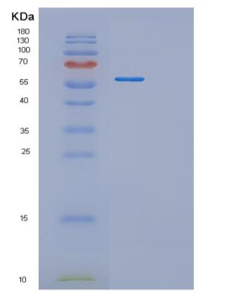 Recombinant Human RNMT Protein