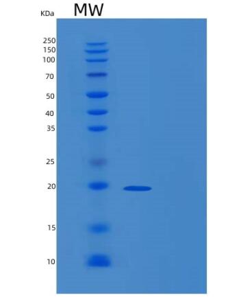 Recombinant Human RP9 Protein