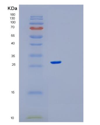 Recombinant Human RPE Protein
