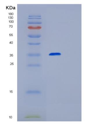 Recombinant Human RPIA Protein