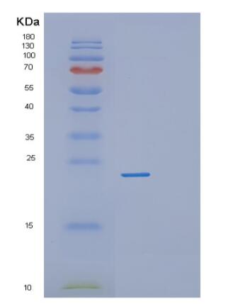Recombinant Human RPL18A Protein