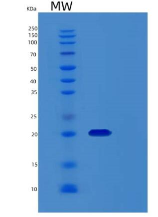 Recombinant HumanRCL Protein