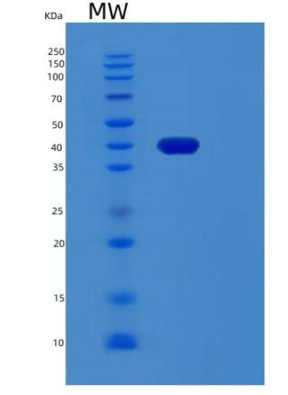 Recombinant Human RCN1 Protein