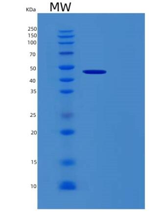 Recombinant Human RBM17 Protein