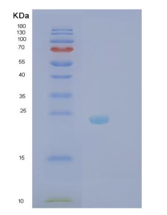 Recombinant Human RhoC Protein