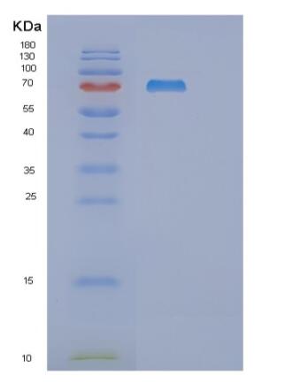 Recombinant Human RNGTT Protein