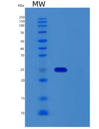 Recombinant Human RBM18 Protein