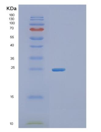 Recombinant Human RGS16 Protein