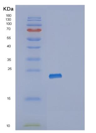 Recombinant Human RPL11 Protein