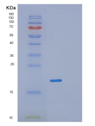 Recombinant Human RPL12 Protein